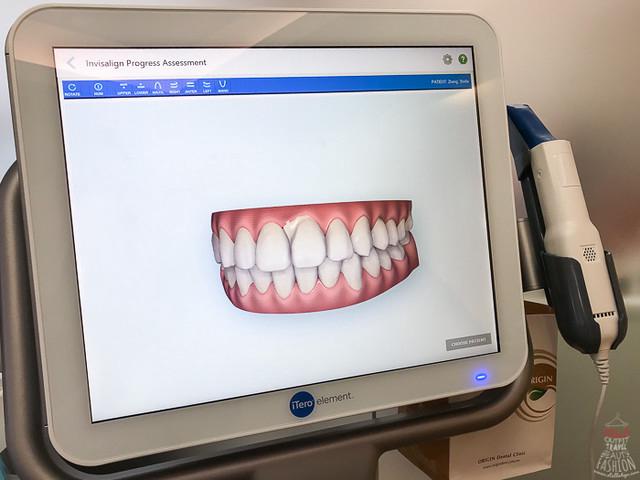 A dentist and patient reviewing a personalized Invisalign treatment plan on a computer screen