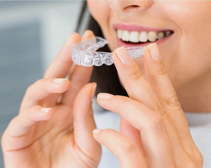 Close-up of Invisalign clear aligners on a set of teeth, showcasing their discreet appearance