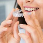 Top Invisalign Dentists Chicago