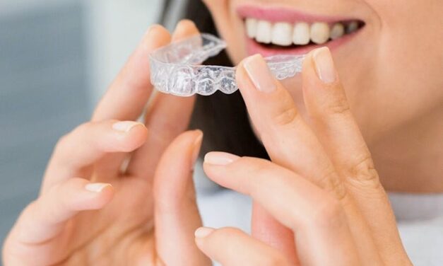 Top Invisalign Dentists Chicago