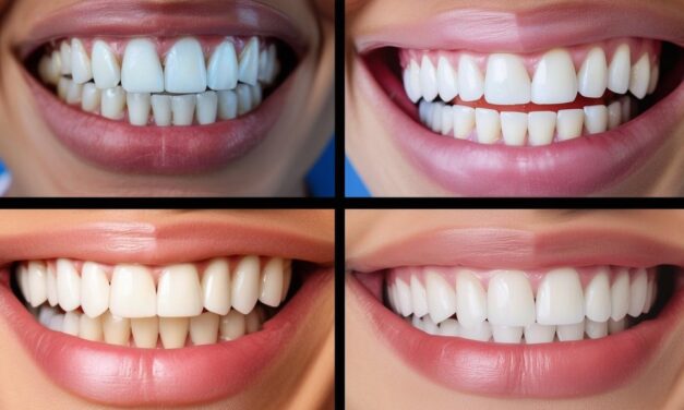 Top Invisalign Dentists DC