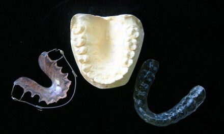 Choosing the Right TMJ Mouth Guard